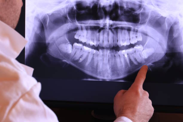 Best Mobile Emergency Dentist in Beaver Creek, TX